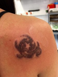 Toisen käsittelyn jälkeen.